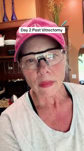 Macular Eye Hole Recovery Face Down in Massage Chair