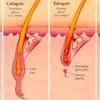 Take your pick and say goodbye to those dreaded waxing appointments for good. 1