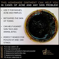 This Homemade Ointment Can Help You In Cases Of Acne And Any Skin Problem Healing Salves Ointment Black Salve Uses