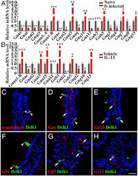 When fully grown, the parasites are capable of causing impairment of respiration. Infection By The Parasitic Helminth Trichinella Spiralis Activates A Tas2r Mediated Signaling Pathway In Intestinal Tuft Cells Pnas