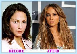 Maybe you would like to learn more about one of these? Jennifer Lopez Plastic Surgery One Of Her Assets Jennifer Lopez Plastic Surgery Plastic Surgery Celebrity Plastic Surgery