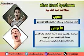 Pin By Future Doctor On Alien Hand Syndrom Future Doctor Alien Hand Syndrome Alien Hand