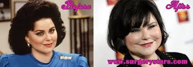 Her appearance looks weird after having some beauty surgeries done. Delta Burke Plastic Surgery Before After Photo