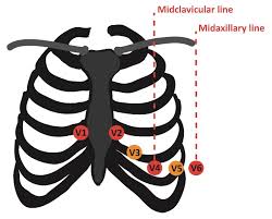 Image result for Point of Maximum Impulse