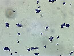 Maybe you would like to learn more about one of these? Mrsa Methicillin Resistenter Staphylococcus Aureus Tierklinik De