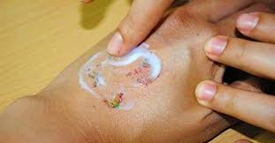 This was my second session at wave plastic surgery for my tattoo removal. New Pain Free Tattoo Removal Cream Invented Tattoodo