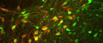 Overview Neurobiology Of Parkinson S Disease Laboratory Mayo Clinic Research
