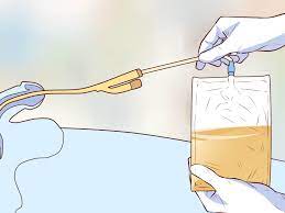 Dibandingkan dengan plastik, lateks memiliki daya tahan yang lebih baik dan lebih fleksibel. Cara Memasang Kateter 11 Langkah Dengan Gambar Wikihow