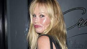 23.01.2013 · did she have plastic surgery to keep her look youthful? Melanie Griffith Plastic Surgery Hollywood Star Almost Unrecognisable News Com Au Australia S Leading News Site