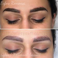 If fading is too much hassle for you or it simply didn't give the expected results, you might want to look into microblading removal. Glycolic Acid To Fade Permanent Makeup Saubhaya Makeup