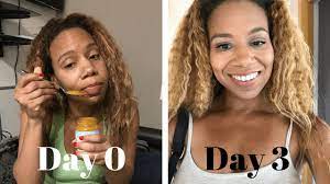 What should you do after wisdom teeth removal? How To Reduce Swelling After Wisdom Teeth Surgery Fast Beauty