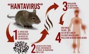 Early symptoms of hantavirus pulmonary syndrome are similar to the flu. Is Hantavirus More Dangerous Than Coronavirus All You Need To Know Malayalam News Indiaglitz Com