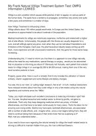 My Frank Natural Vitiligo Treatment System Test Omfg Information Leaked By Karim Bork Issuu