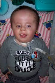 Special Needs Spotlight: Aaron » This Little Miggy