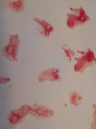 Image result for rev12 my right pointer finger with blood on it