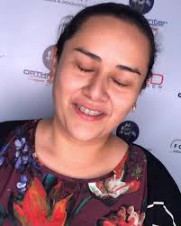 Nuestra Paciente, la Dra. Marcela Navarrete nos ha visitado este día en su  cita de Control Mensual de Brackets y hoy se le dió la buena noticia que  dentro de 8 días será su remoción de Brackets 🤯😍🤩. ...