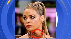 Denise richards has quickly become one of the most talked about figures on the real housewives of beverly hills. Denise Richards Treats An Enlarged Thyroid After Fans Noticed It On Tv Video Abc News