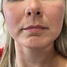 Rose Facial Aesthetics