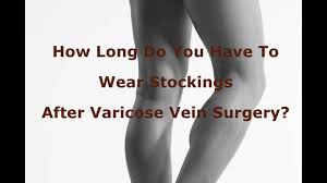 Check spelling or type a new query. How Long Do You Have To Wear Stockings After Varicose Vein Surgery Youtube