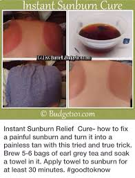 Sun Burn Relief Cure For Sunburn Sunburn Relief Sunburn Remedies
