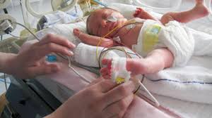 Le prématuré moyen (de 32 sa à 36sa+6 j). Premature Chanter Benefique Pour Bebe Et Maman