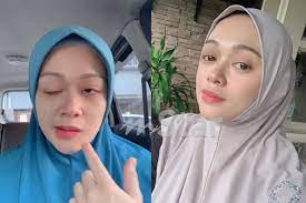 We don't have a biography for faye kusairi. Faye Kusairi
