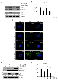 An installation of adobe after effects cc is required. Cancers Free Full Text Cnot2 Is Critically Involved In Atorvastatin Induced Apoptotic And Autophagic Cell Death In Non Small Cell Lung Cancers Html