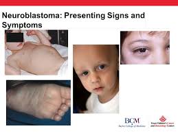 What are the symptoms of skin cancer in a child? Pediatric Oncology For The Primary Care Provider Kate A Ppt Download