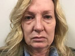 Highly Recommend Dr. Cameron Chestnut and Staff