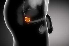 > bonjour, ces derniers temps, je me suis penchée sur le test de l'aneros pour approfondir le massage de la prostate. Ablation De La Prostate Consequences Risques Indications