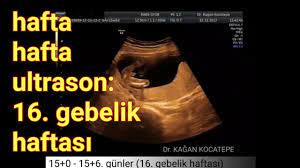 Watch & download video bebeğin cinsiyeti ne zaman belli olur. 16 Gebelik Haftasinda Anne Karnindaki Erkek Bebek Aciklamali Ultrason Goruntuleri Youtube