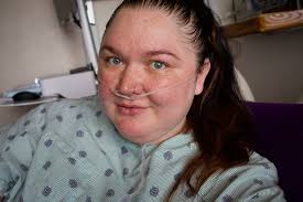 How to lose weight gained from steroid treatment?