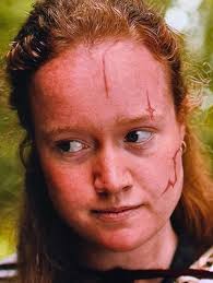 Do you think the scar above Van's eye is