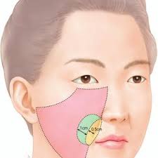 An 18-year-old woman was hurt