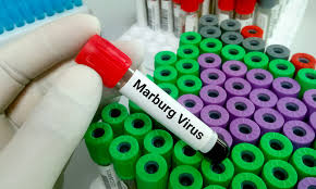Mvd is a viral hemorrhagic fever (vhf), and the clinical symptoms are indistinguishable from ebola virus disease (evd). X9rxvuj3g8bkum