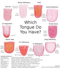 Which Tongue Are You Tongue Health Health Health Facts