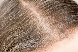For the best results, draw on your grey hair strands starting from your hair part and working your way down your scalp. How To Get Rid Of Gray Hair Getridofthings Com