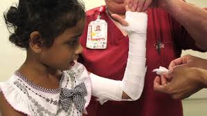 Image result for Long Arm Splint