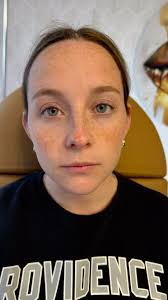 ✨💉Enhance your natural beauty with customized lip enhancements at Uplifted  by Jen. Whether you desire defined borders, added volume, or just a  confidence boost, we tailor each treatment to fit your ...