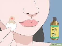 Les boutons blancs et autres imperfections cutanées dont on se passerait bien. 4 Manieres De Se Debarrasser Des Boutons Sous Cutanes