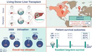 Image result for Transplantation