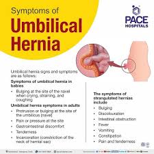 Image result for stomach hernia symptoms