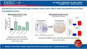 We did not find results for: How To Treat Mesothelioma With A Tumor Stem Cell Inhibitor Pdf Free Download