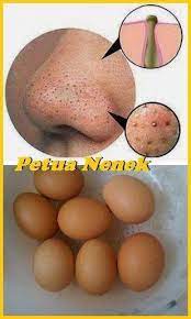 Setelah mengetahui beberapa cara menghilangkan komedo hitam di hidung dengan cepat dan alami, anda juga harus mengetahui bagaimana cara mencegah munculnya komedo di hidung? Facebook