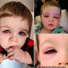 Mom warns about hidden bath toy danger after toddler nearly loses his  vision. Moms, watch out for these toys! They are extremely dangerous for  little ones! Check the comments 👇