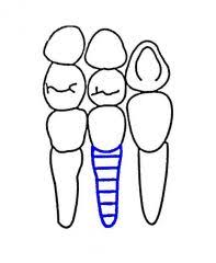 dental charting flashcards cram com