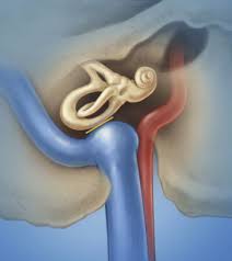 Image result for Venous Hum