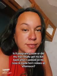 Understanding Postpartum Swelling: My Experience