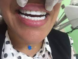 However, for the rest of us, it can be a little challenging. Snap On Smile Home Facebook