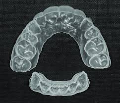 What is a plastic retainer? The Essix Retainer Covering All Teeth In The Maxilla And From Canine To Download Scientific Diagram